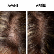 RÉGÉNÉRESCENCE NATURELLE