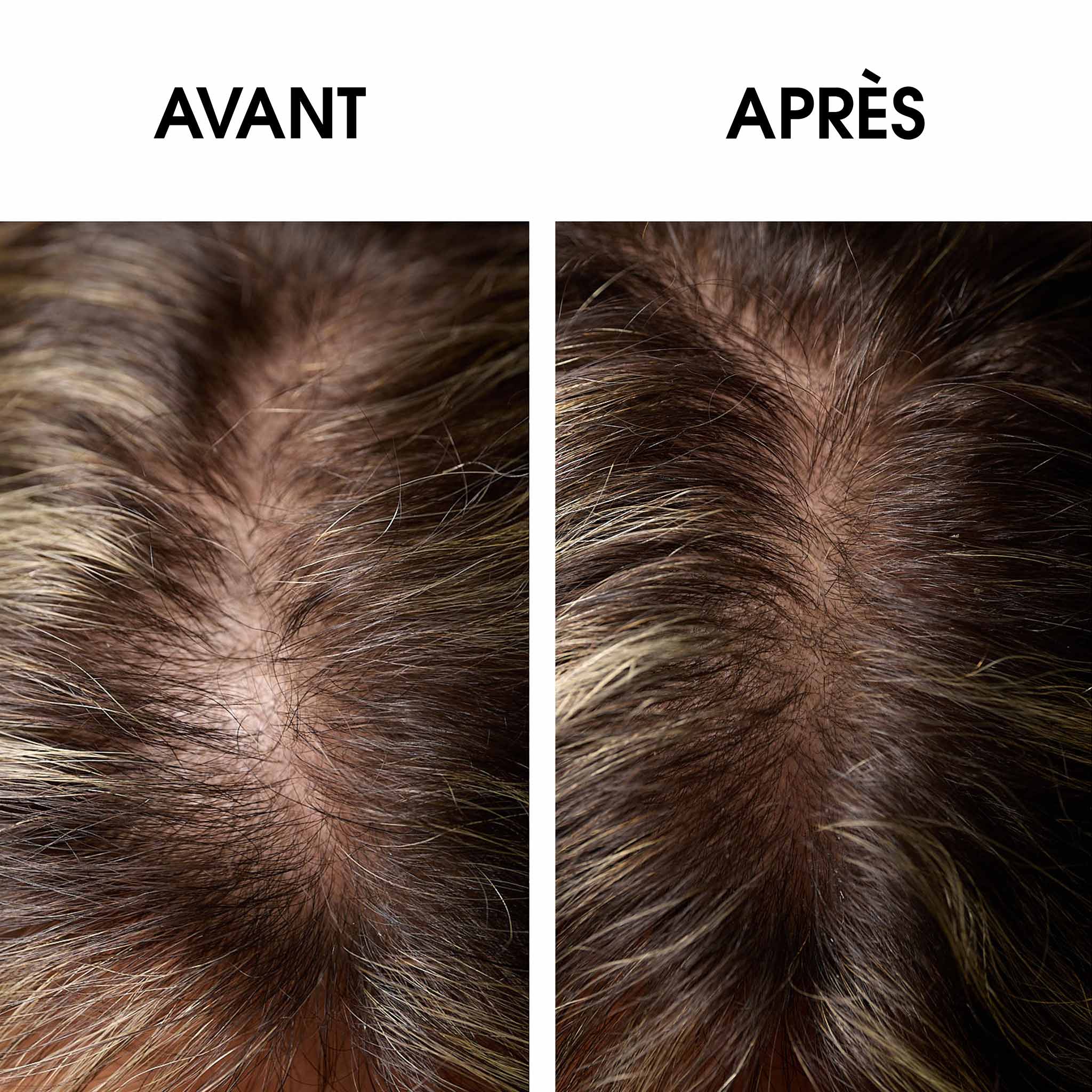 RÉGÉNÉRESCENCE NATURELLE